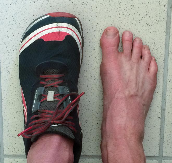 Conrad Stoltz Altra Running Lone Peak 2.0 Footshape toe box_